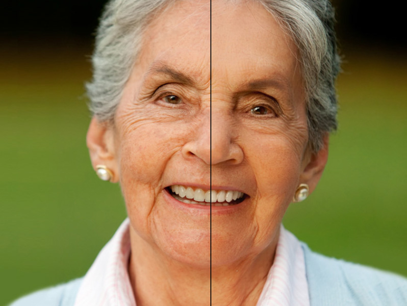 PHOTO-EXPRESS-PHOTOSHOOT-AUSTRALIA-WEDDINGS-PHOTO-RESTORATION-2009